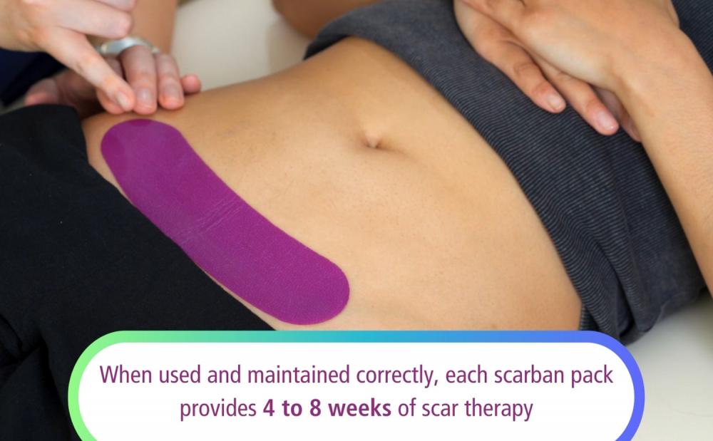 When used and maintained correctly, each Scarban pack provides 4 to 8 weeks of scar therapy