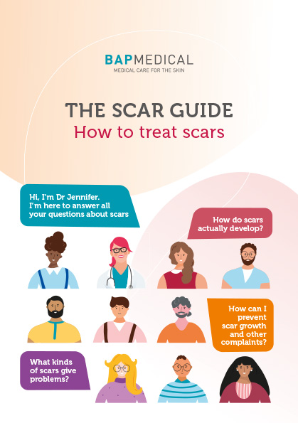 Scar Guide - How to treat scars