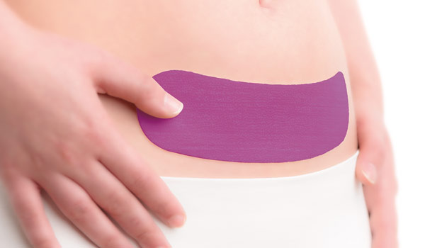 Silicone sheet for a C-section scar
