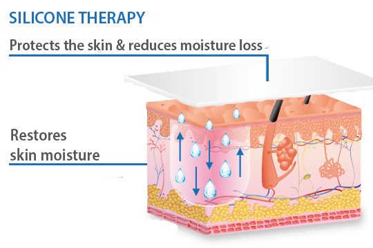 C-section scar treatment