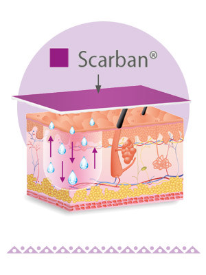 Scarban C-Section - clinically proven